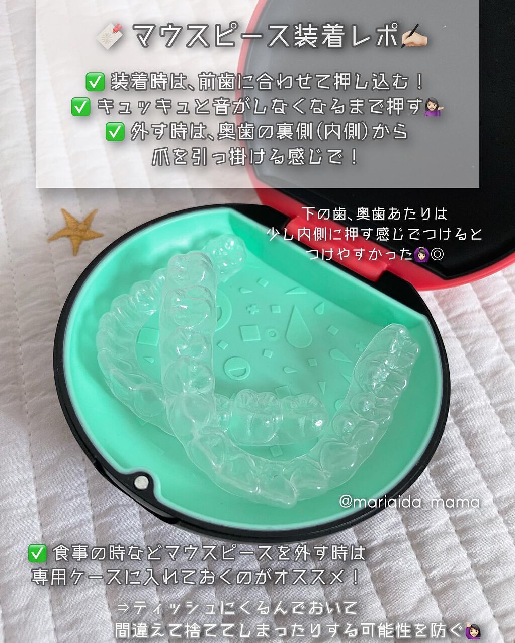 愛田まり(まりりん) on LIPS 「𓂃𓈒𓏸🗣マウスピースってどんな感じ❔アットスマイル矯正体験レポ..」(2枚目)