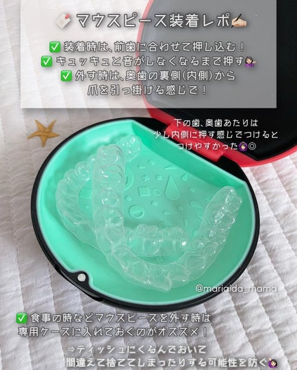 愛田まり(まりりん) on LIPS 「𓂃𓈒𓏸🗣マウスピースってどんな感じ❔アットスマイル矯正体験レポ..」(2枚目)