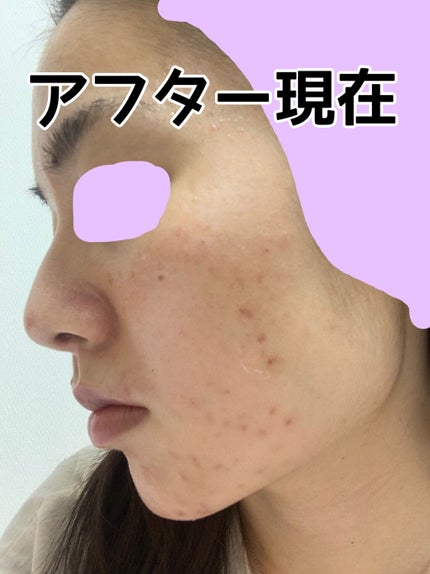 フレッシュリージュースドビタミンドロップ(35ml)/Klairs/美容液を使ったクチコミ(4枚目)