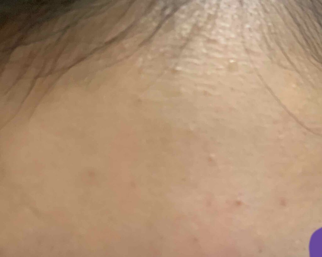 明色美顔水 薬用化粧水/美顔/化粧水を使ったクチコミ（2枚目）