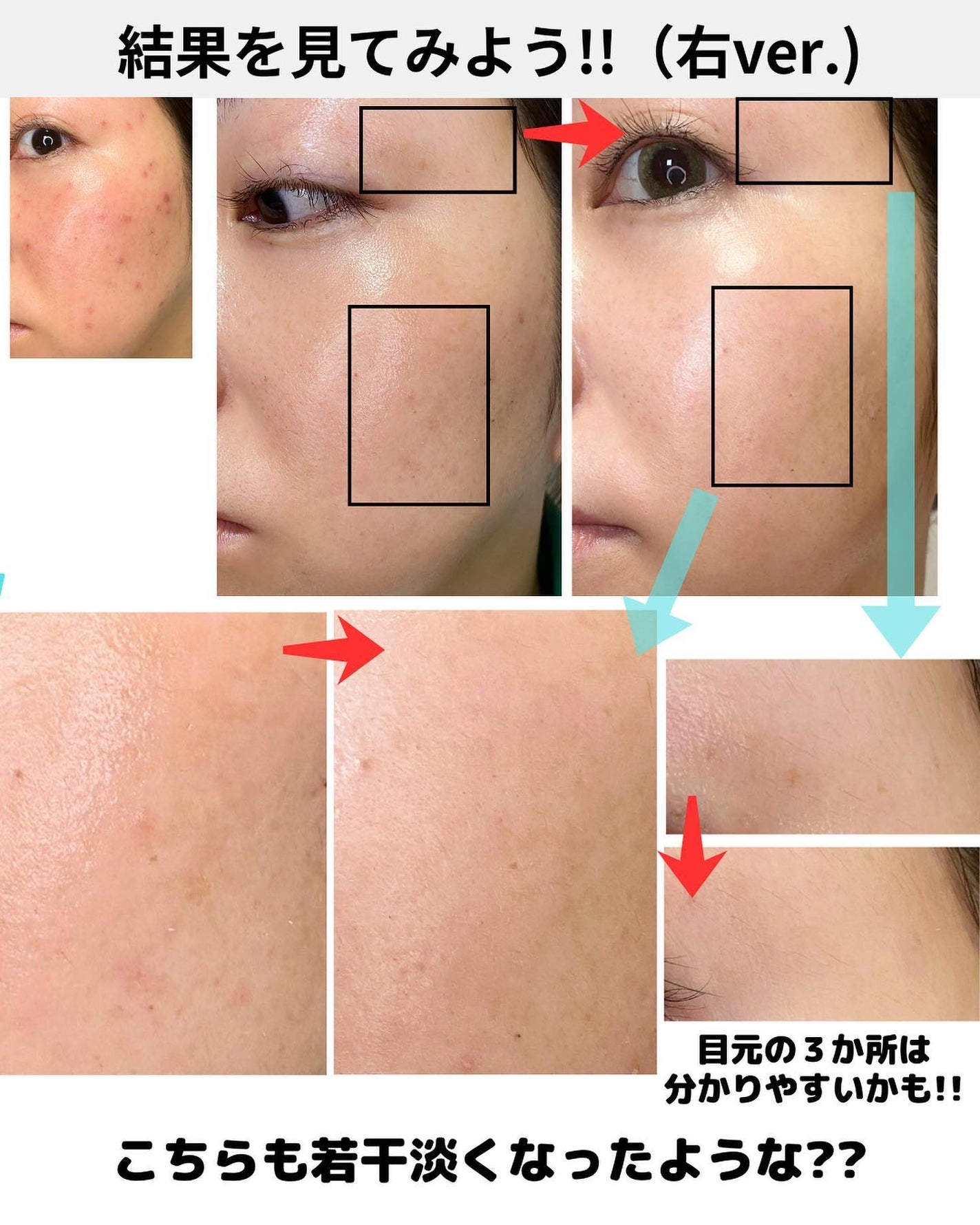 めがねちゃん👓フォロバ on LIPS 「←こちらから過去のおすすめが見られます✨元化粧品研究者のめがね..」(8枚目)