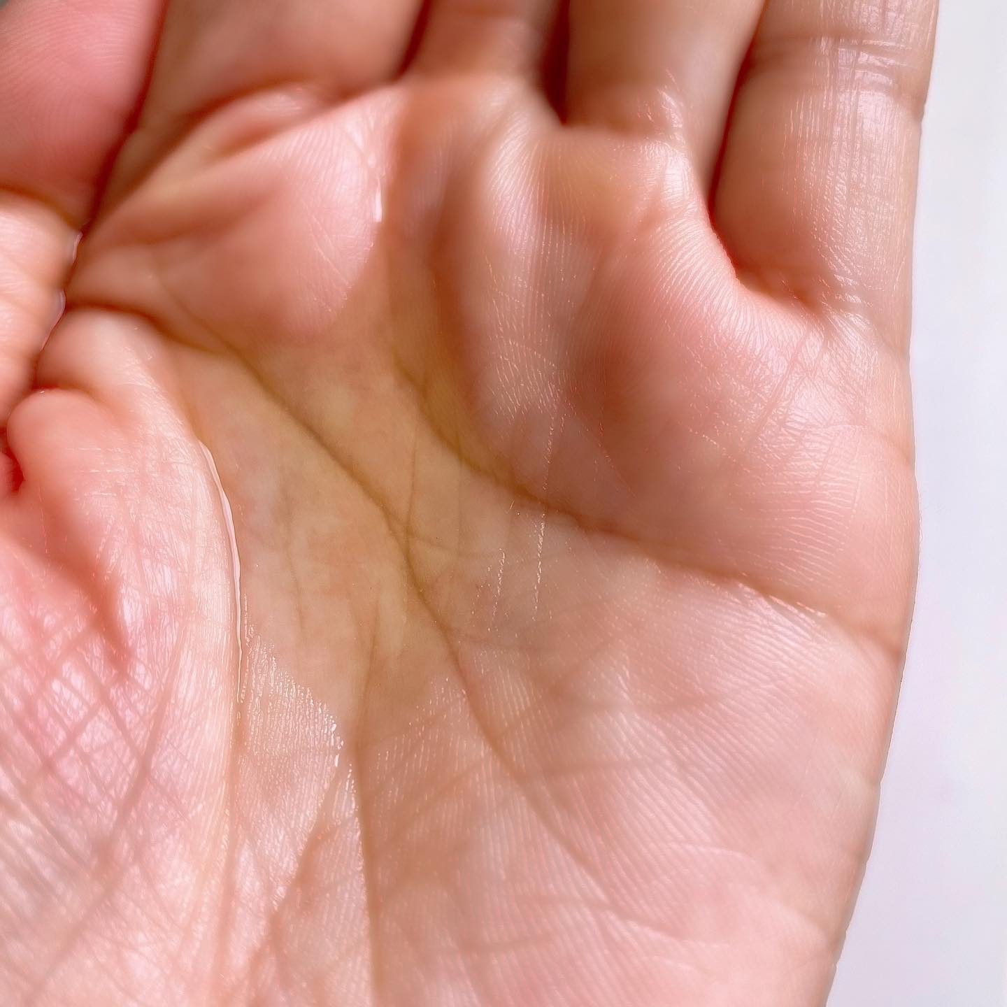 V エッセンス/unlabel/美容液を使ったクチコミ（2枚目）