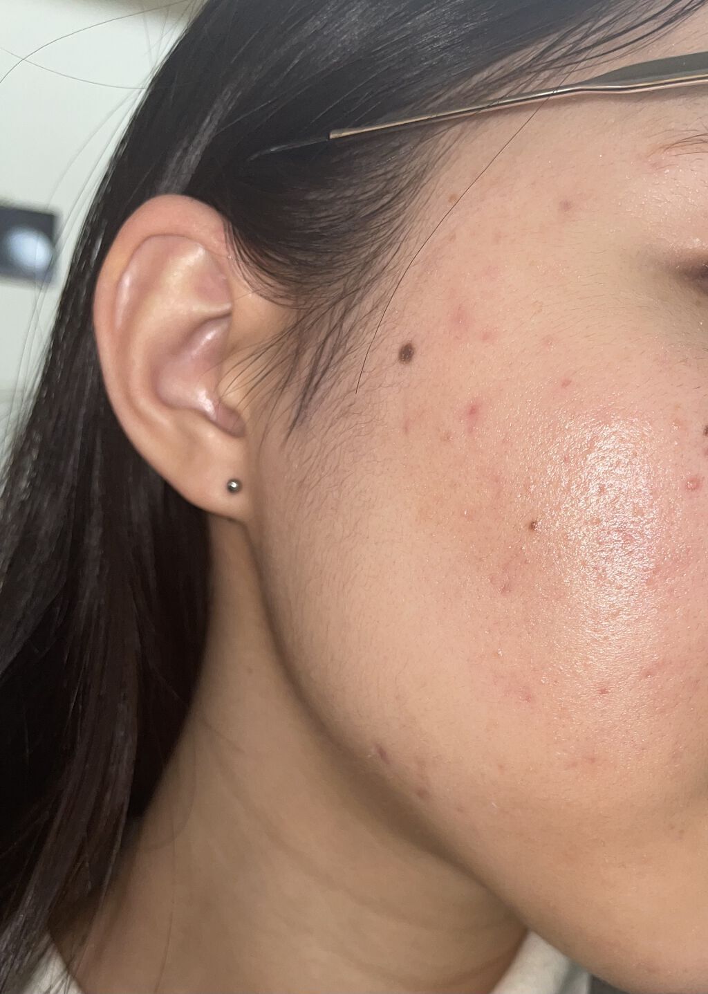 ハトムギ化粧水(ナチュリエ スキンコンディショナー R )/ナチュリエ/化粧水を使ったクチコミ（2枚目）