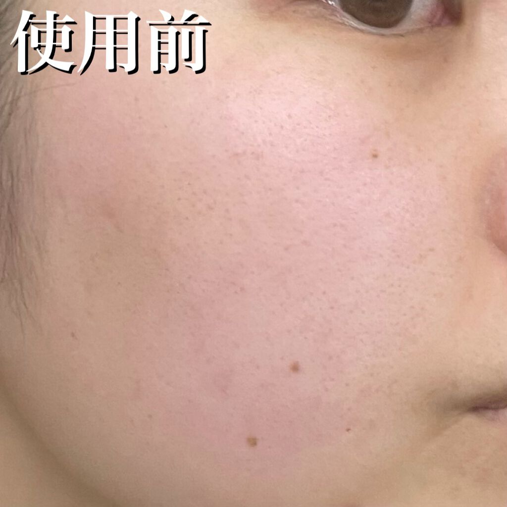 フルフィットプロポリスシナジートナー/COSRX/化粧水を使ったクチコミ(7枚目)