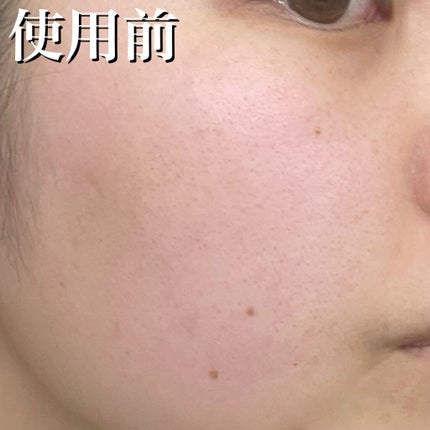 フルフィットプロポリスシナジートナー/COSRX/化粧水を使ったクチコミ(7枚目)