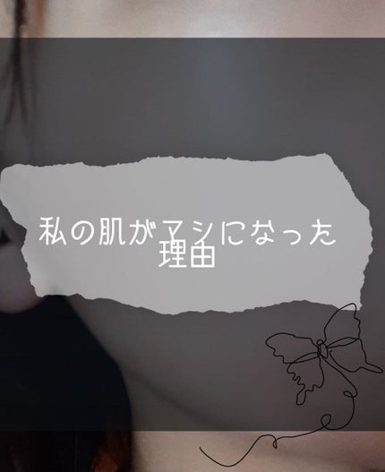 オロナインH軟膏 (医薬品)/オロナイン/その他を使ったクチコミ(1枚目)