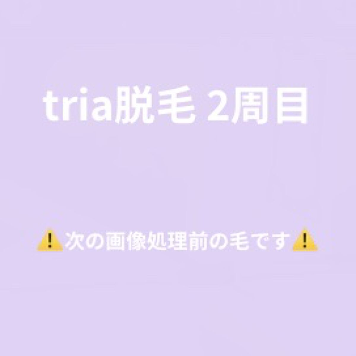 トリア・パーソナルレーザー脱毛器 4X/トリア/家庭用脱毛器を使ったクチコミ（1枚目）