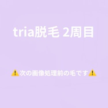 トリア2周目に入りました！

前回の投稿はハッシュタグで出てきます
#おふとんtria

脛の照射、お手入れ前の写真を載せています。
体感では打ってない時とまだ特に変化は感じていません。
同じ部位で毎回