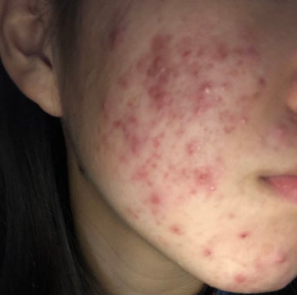 を使ったクチコミ(2枚目)