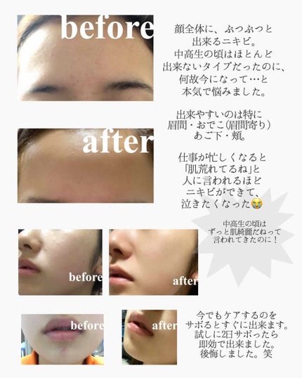 ティーツリーケア ソリューション エッセンシャルマスクEX/MEDIHEAL/シートマスク・パックを使ったクチコミ(3枚目)