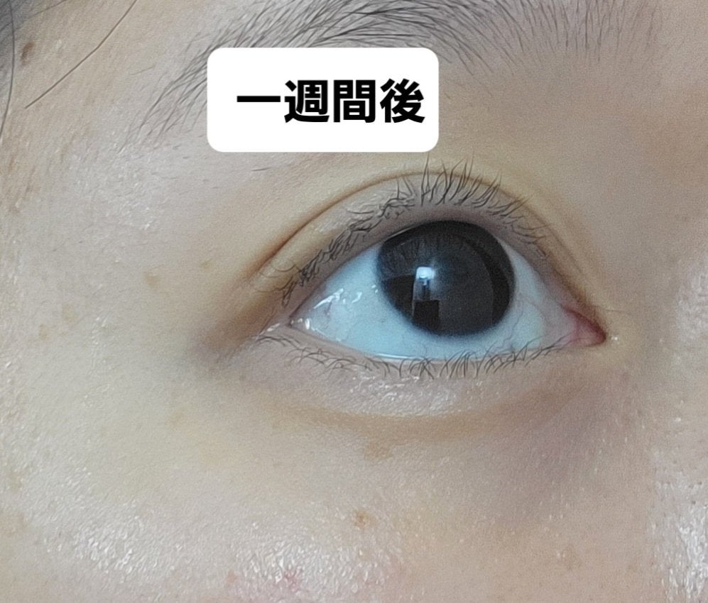 リポソーム アドバンスト リペアアイセラム/DECORTÉ/アイケア・アイクリームを使ったクチコミ(4枚目)