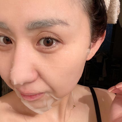 ダーマレーザー スーパーセラミド100マスク/クオリティファースト/シートマスク・パックを使ったクチコミ(4枚目)