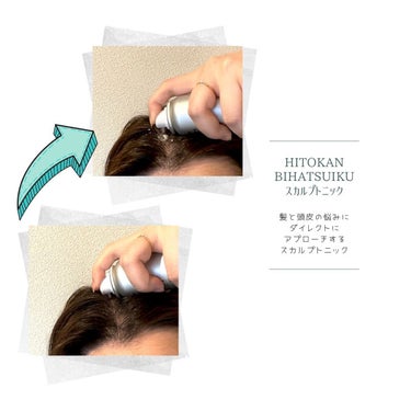HITOKAN BIHATSUIKU スカルプトニック/fracora/頭皮ケアを使ったクチコミ（3枚目）