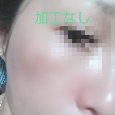 ボヨンボヨン on LIPS 「皆さんは毛穴で悩んでる！ッて方多いですか？私は10代２０代とニ..」（4枚目）