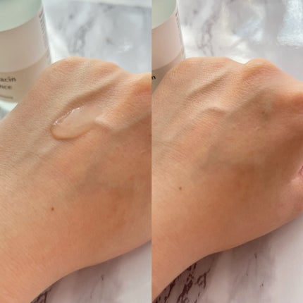 ガラクナイアシン2.0エッセンス/manyo/美容液を使ったクチコミ(4枚目)