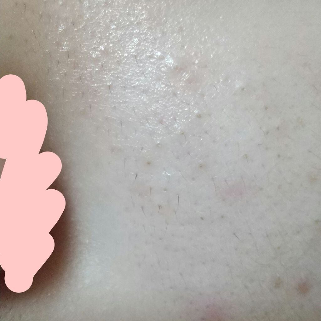 Liu on LIPS 「こんにちは🍒今回が初投稿なのでまだよく分かりませんが助けて頂け..」(4枚目)