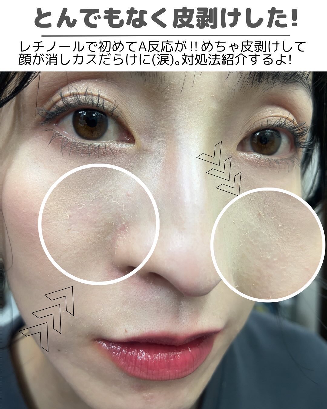 メディプラスゲル/メディプラス/オールインワン化粧品を使ったクチコミ（2枚目）