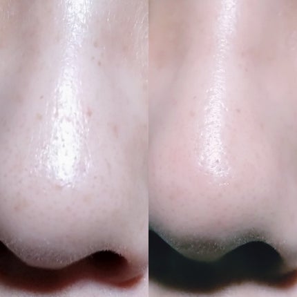 5番 白玉グルタチオンC美容液/numbuzin/美容液を使ったクチコミ(9枚目)