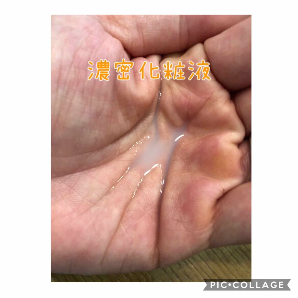 フローラドリップ/ALBION/化粧水を使ったクチコミ（2枚目）