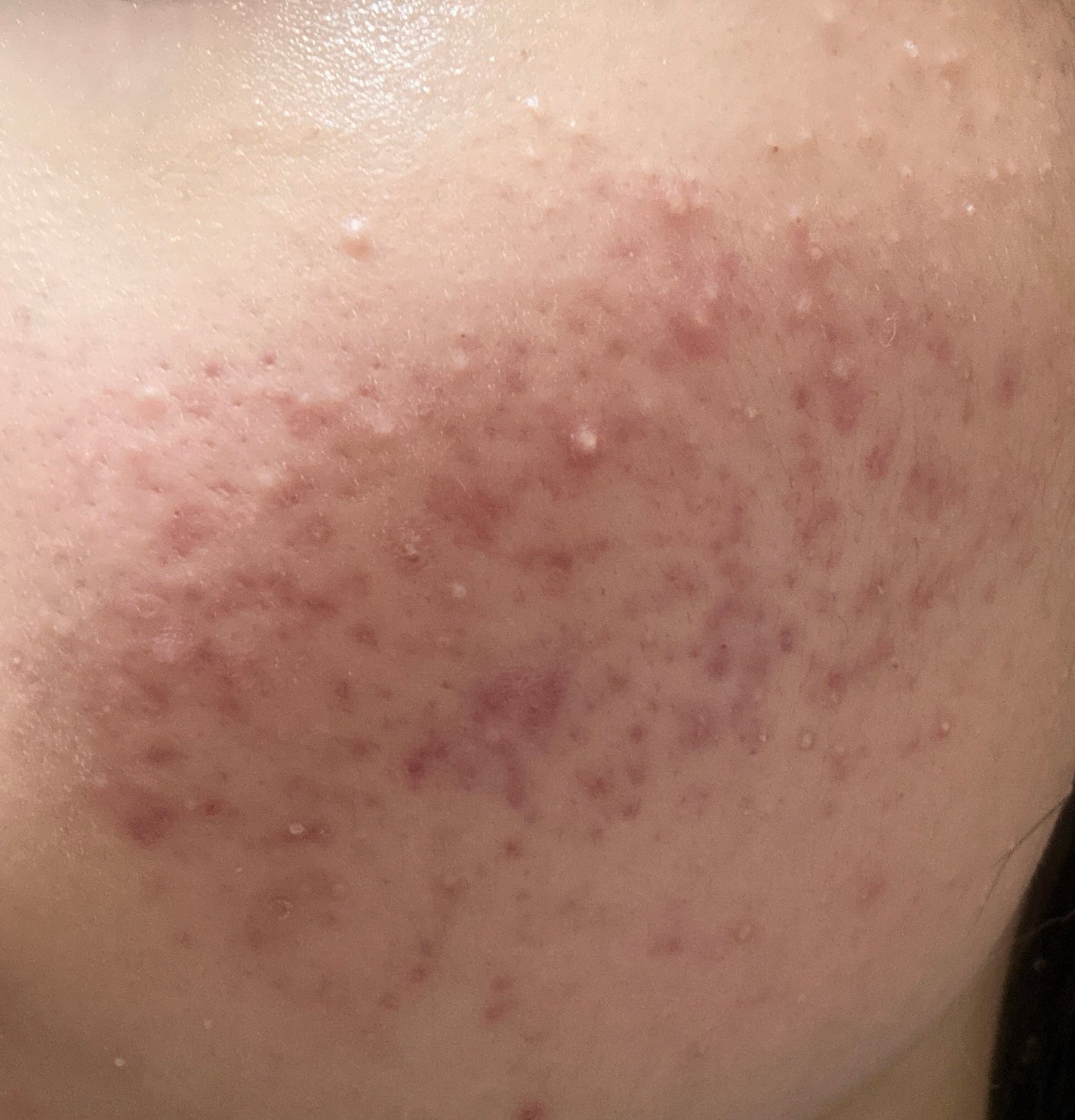 ð§ð»ãããïŒãããè·¡æ²æ»
âð»âª on LIPS ãèèãæ¥èšâ£ã ãã¶èµ€ã¿ãžã£ãŠããã§ãçœããããäžçããããð¡..ãïŒ2æç®ïŒ