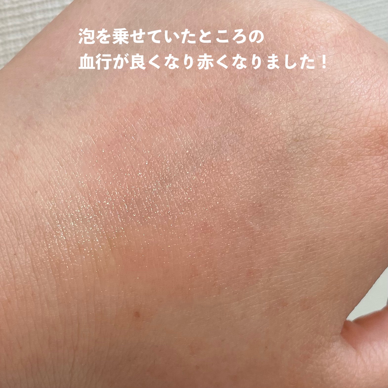 ソフィーナ iP 薬用シワ改善 泡セラム 本体 90g/SOFINA iP/美容液を使ったクチコミ（3枚目）