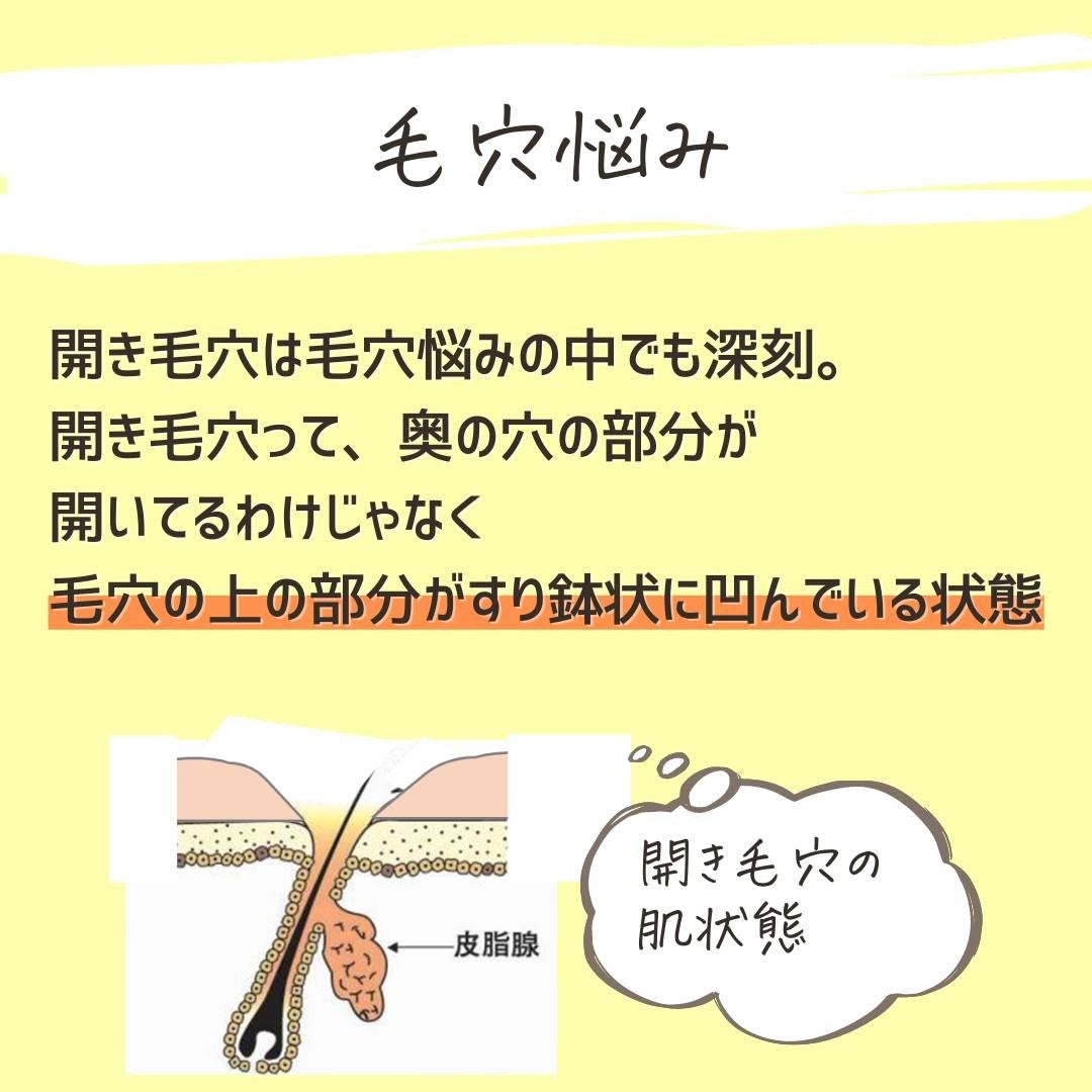 とまと村長@化粧品研究者 on LIPS 「←スキンケアオタクは投稿を要チェック!化粧品研究者のとまと村長..」(4枚目)
