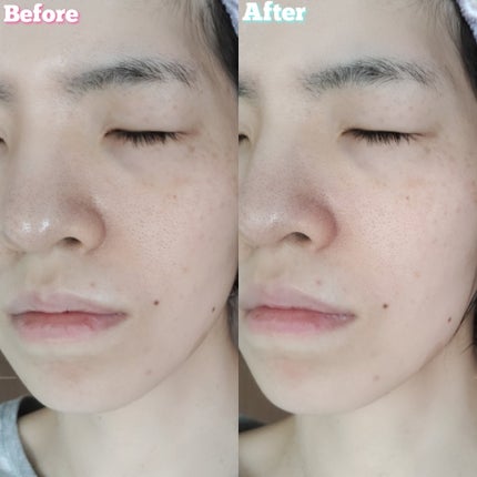 ロゼット洗顔パスタ アクネクリア/ロゼット/洗顔フォームを使ったクチコミ(7枚目)