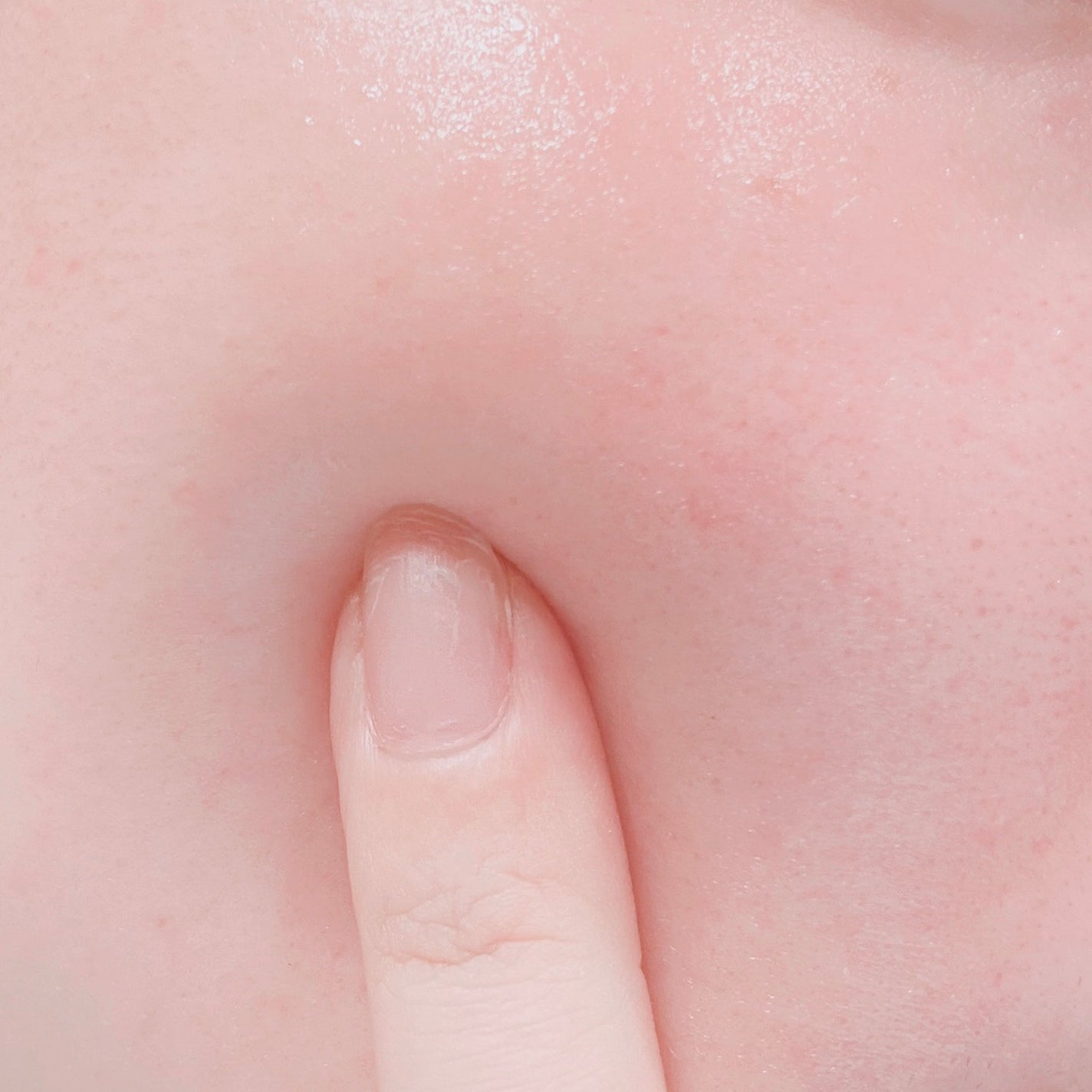 ピンクティーツリーシナジーセラム/APLIN/美容液を使ったクチコミ(4枚目)