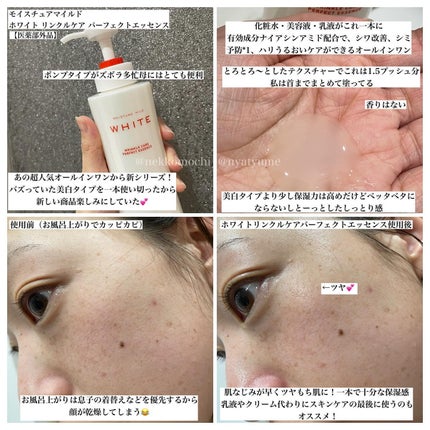 モイスチュアマイルドホワイトリンクルケア パーフェクトエッセンス/モイスチュアマイルド ホワイト/オールインワン化粧品を使ったクチコミ(2枚目)