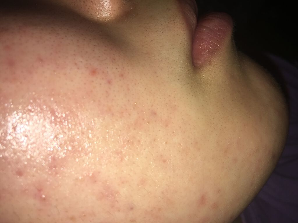 ハトムギ化粧水(ナチュリエ スキンコンディショナー R )/ナチュリエ/化粧水を使ったクチコミ（1枚目）