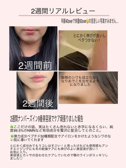9番 NMNバイオリフト濃縮美容液/numbuzin/美容液を使ったクチコミ(2枚目)
