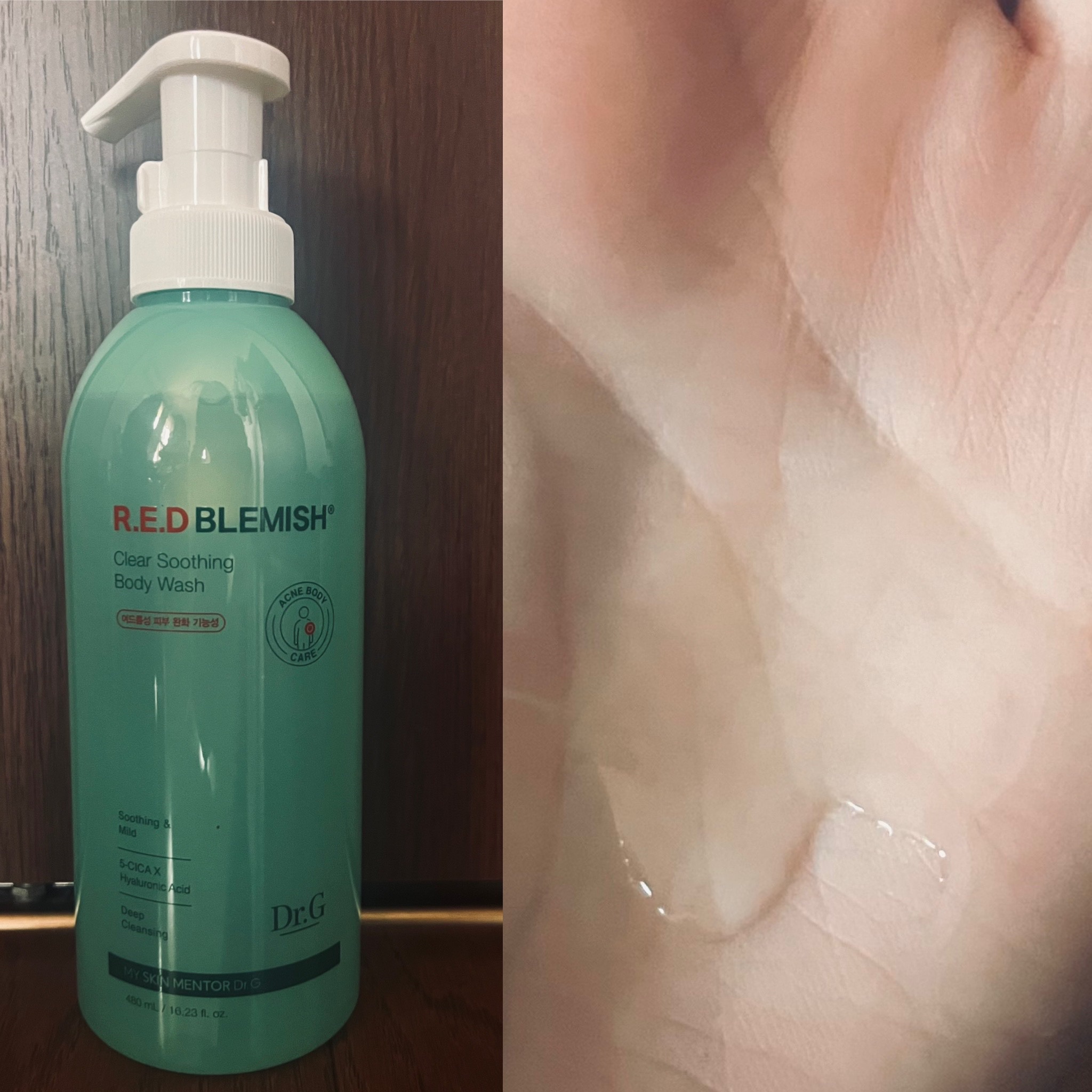 レッドブレミッシュスージングボディウォッシュ/Dr.G/ボディソープを使ったクチコミ（1枚目）