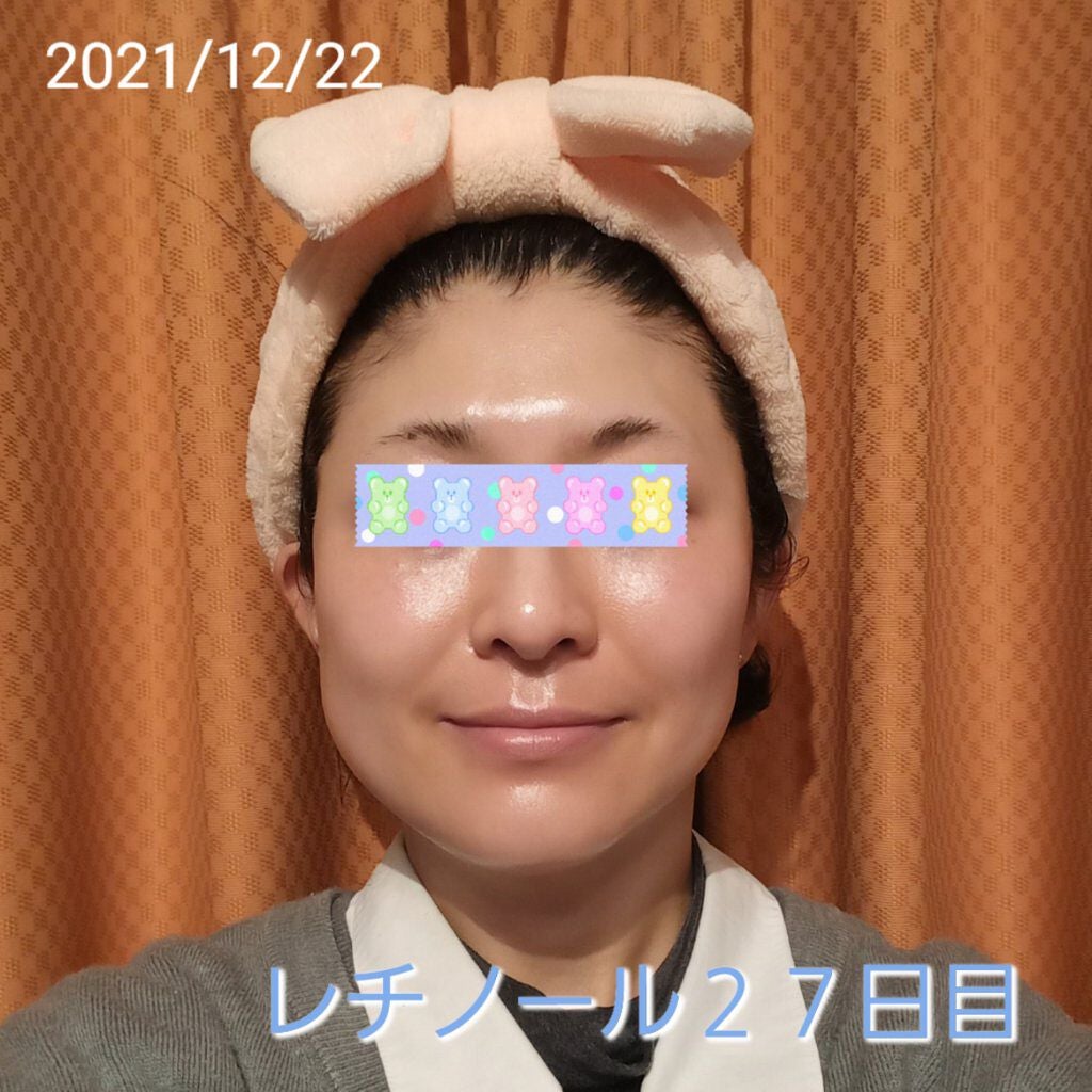 トレチノインジェル/A-Ret/美容液を使ったクチコミ(1枚目)