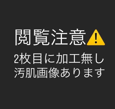 エムディア　EGF リニューセラム/M-Dear/美容液を使ったクチコミ（1枚目）