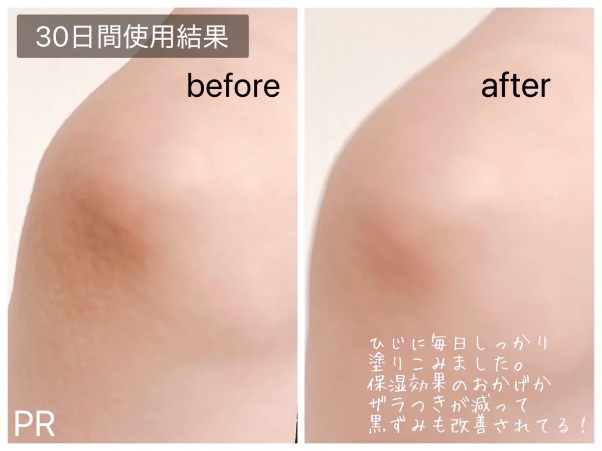 BnDアンダーアームクリーム(ボディクリーム)/BnD/デリケートゾーンケアを使ったクチコミ（3枚目）