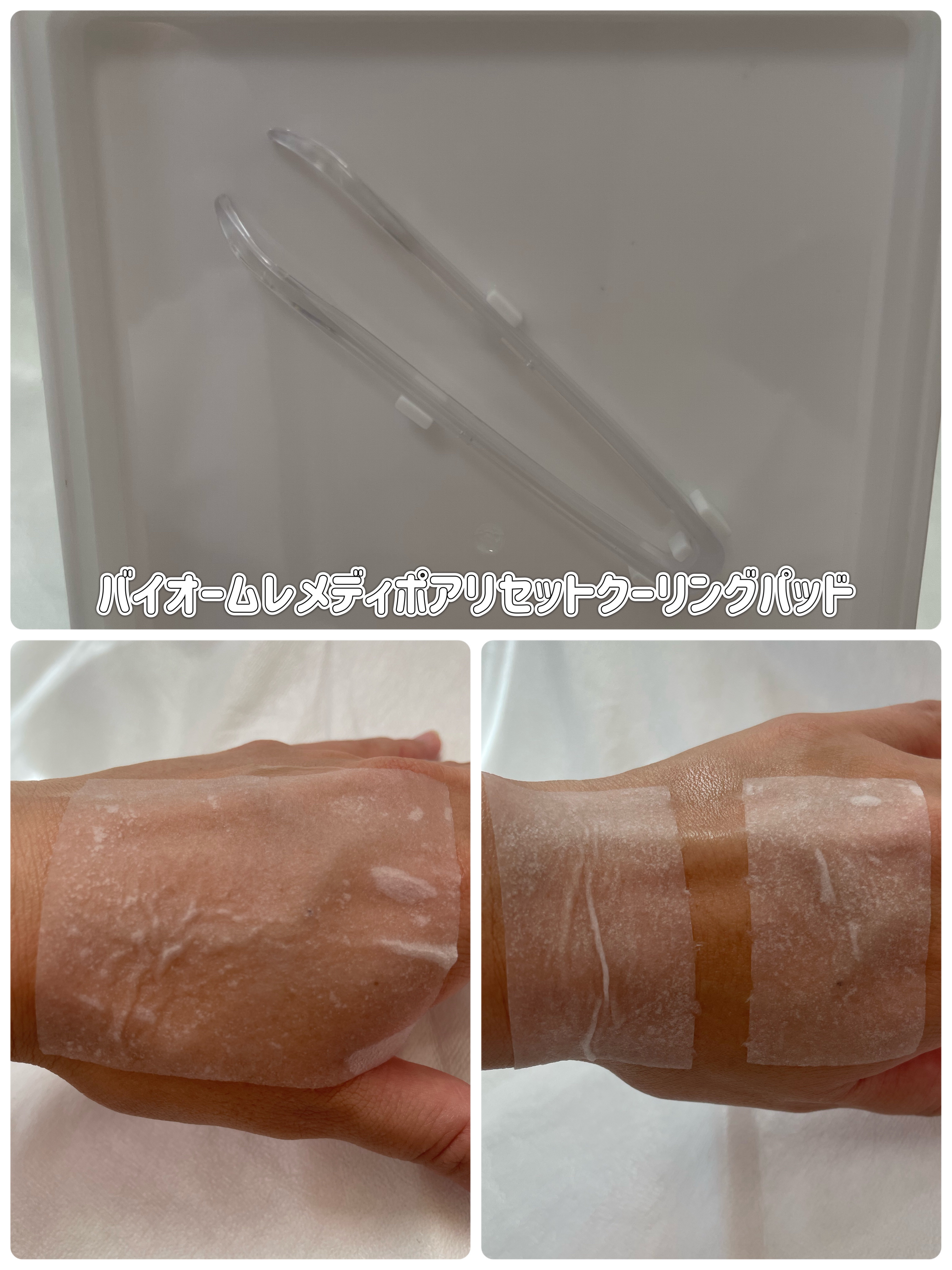 バイオームビタCダークスポットセラム/UIQ/美容液を使ったクチコミ（2枚目）