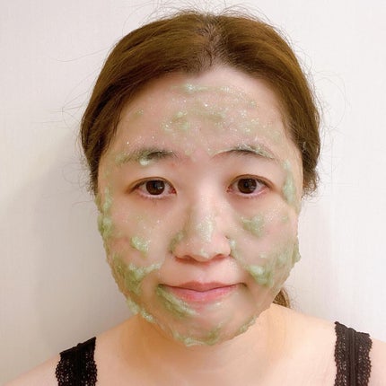 ニードル炭酸パック/NNE/洗い流すパック・マスクを使ったクチコミ(9枚目)