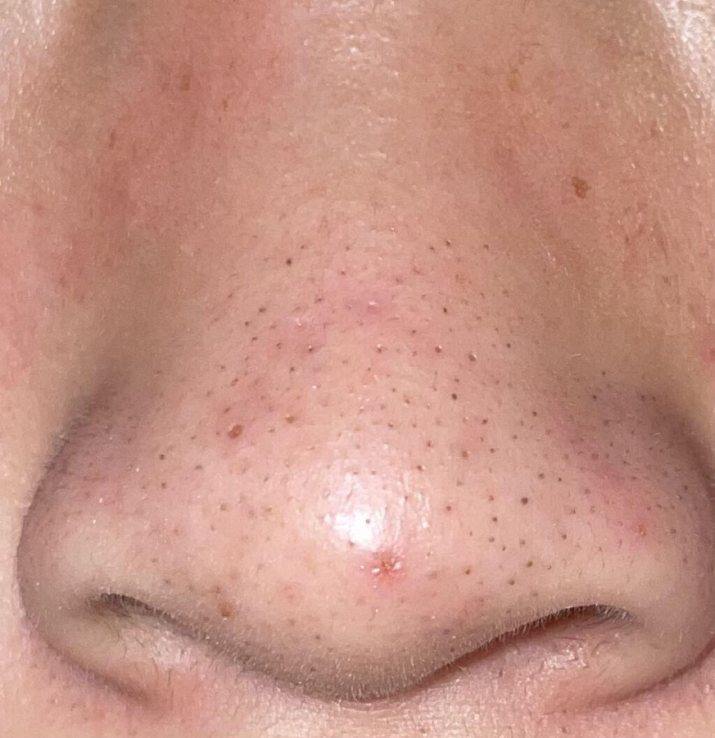 ホホバオイル/無印良品/ボディオイルを使ったクチコミ（1枚目）