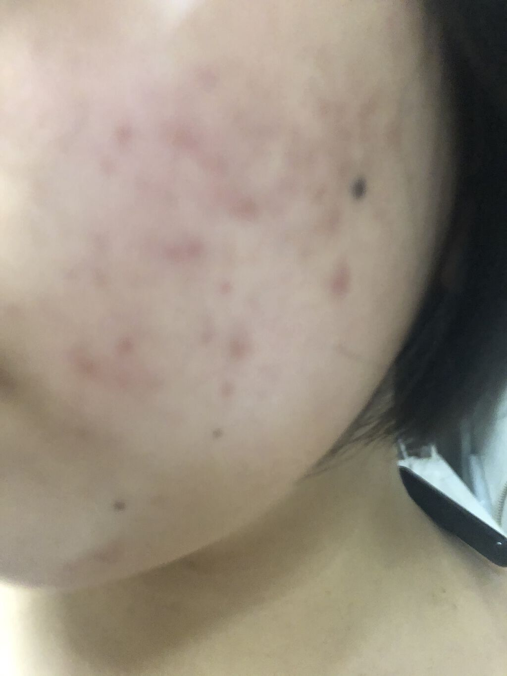 保湿浸透水モイストリッチ/肌をうるおす保湿スキンケア/化粧水を使ったクチコミ（3枚目）