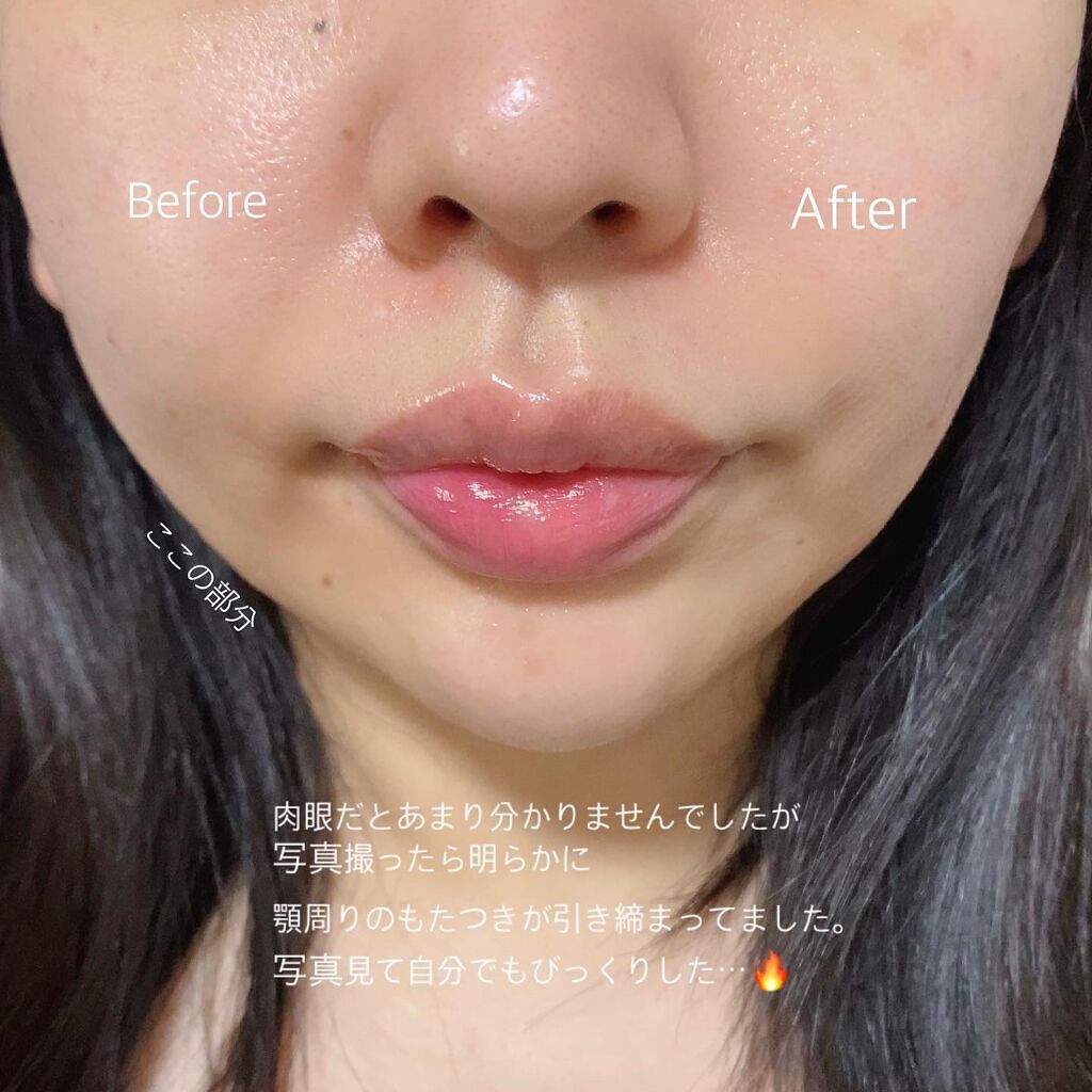 Age-Rブースタージェル|MEDICUBEを使った口コミ - 【medicube AGE-R