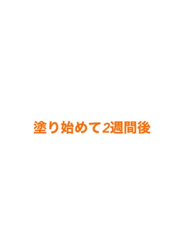 こぐまちゃん on LIPS 「今日で(日付変わっちゃったけど)塗り始めて2週間経過5日くらい..」（1枚目）