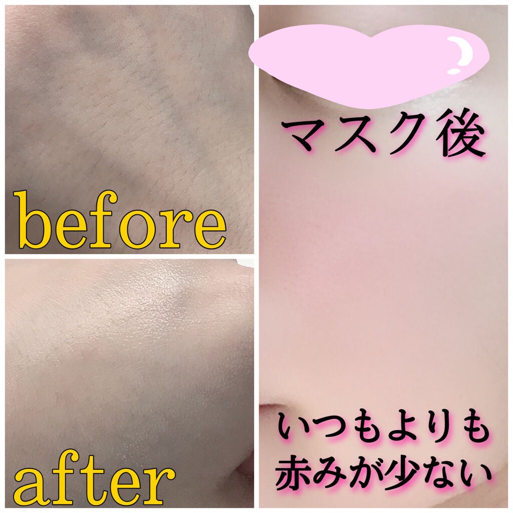 ナノセーブ バリアリフレッシュミスト/ジュン・コスメティック/ミスト状化粧水を使ったクチコミ(5枚目)