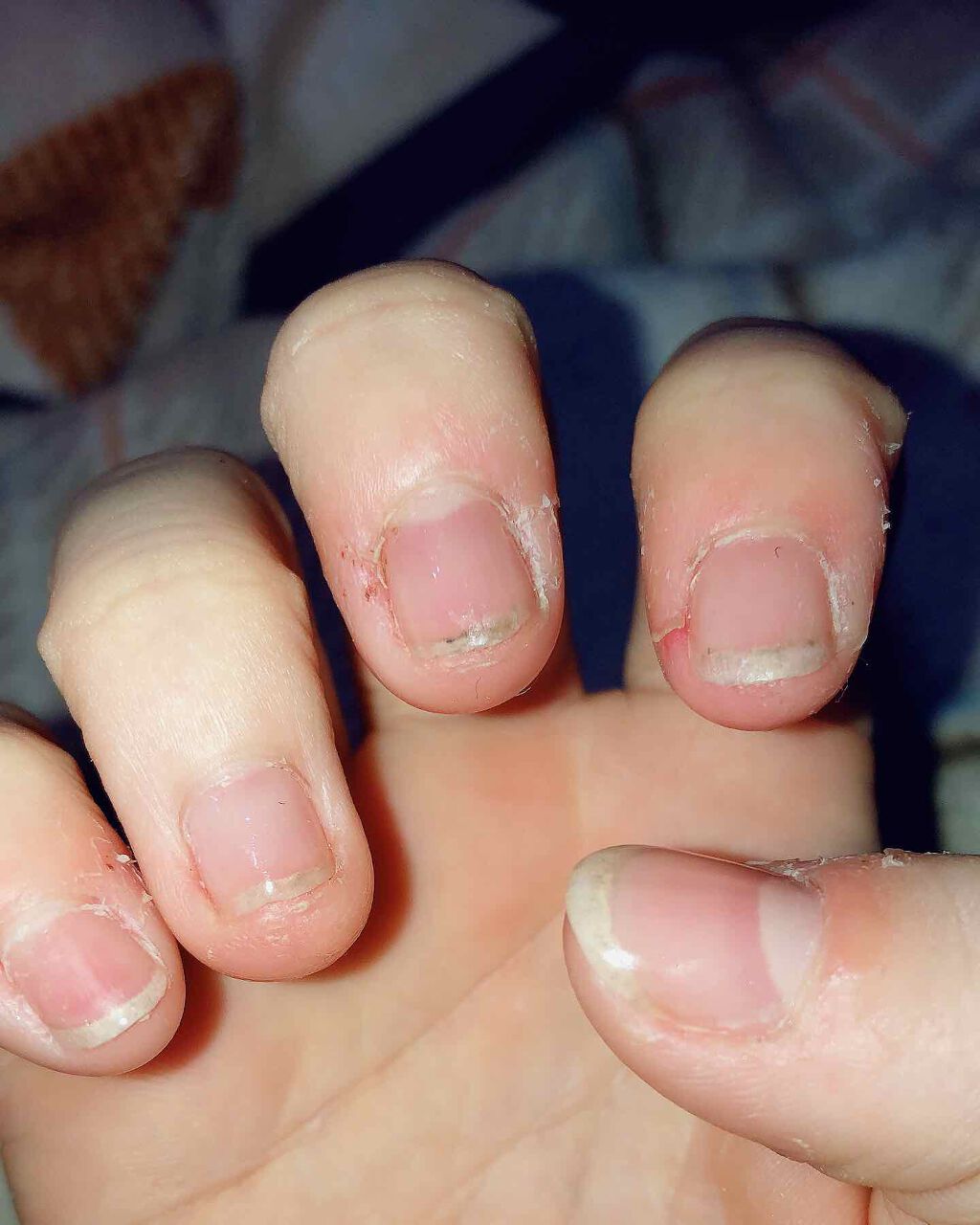 カラフルネイルズ TO(トリートメントオイル)/キャンメイク/ネイルオイル・トリートメントを使ったクチコミ（2枚目）