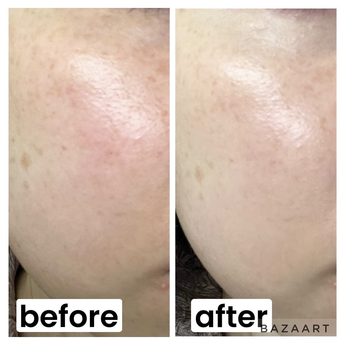 ブリージンググロークッション/Healus/クッションファンデーションを使ったクチコミ(5枚目)