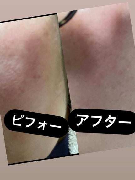 パーフェクトCビタセラム/TIRTIR(ティルティル)/美容液を使ったクチコミ(6枚目)