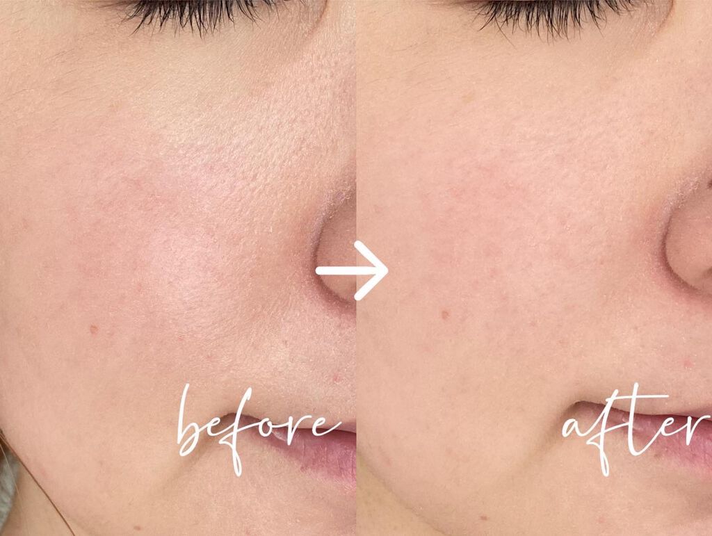 アドバンスドエシリアルスムースオペレーター ルースパウダー/THREE/ルースパウダーを使ったクチコミ（1枚目）