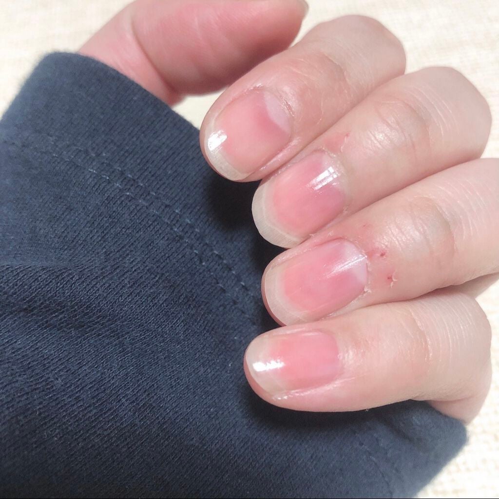 エテュセ クイックケアコート/ettusais/ネイルオイル・トリートメントを使ったクチコミ(2枚目)