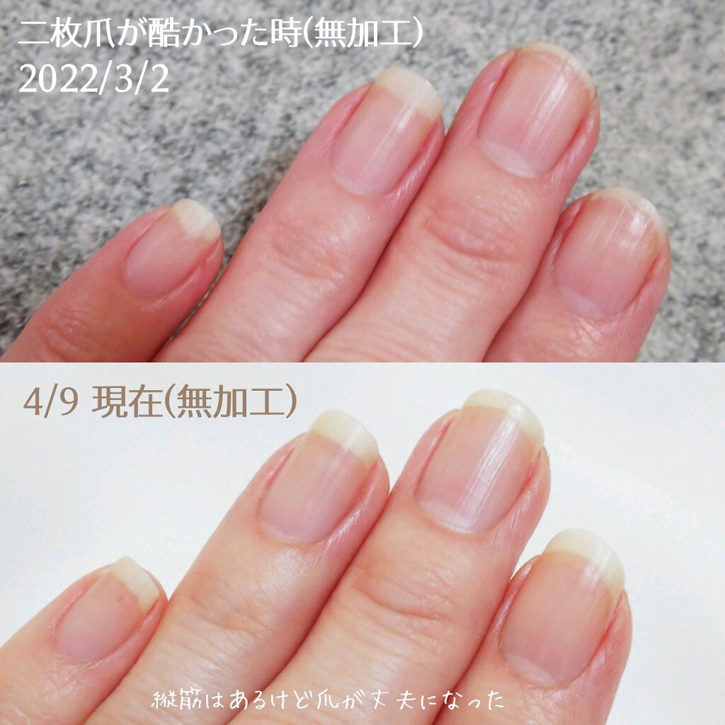 ハンドベール プレミアムリッチネイル/メンソレータム/ネイルオイル・トリートメントを使ったクチコミ(9枚目)