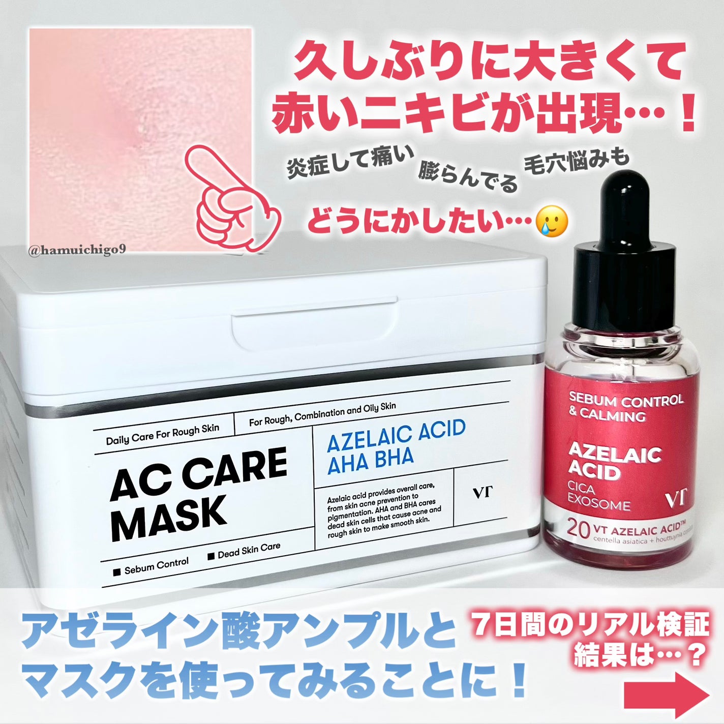 プロCICA クリアスポットパッチ/VT/その他スキンケアを使ったクチコミ(2枚目)