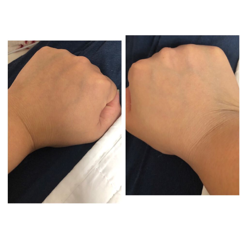 デュイセル ターンオンクリーム/DEWYCEL/フェイスクリームを使ったクチコミ（2枚目）